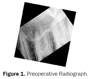 dental-sciences-Preoperative