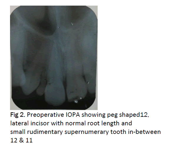 dental-sciences-Preoperative-IOPA