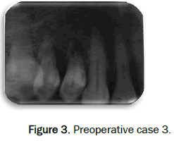 dental-sciences-Preoperative-case-3