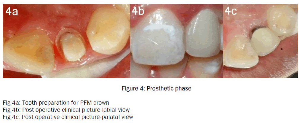 dental-sciences-Prosthetic