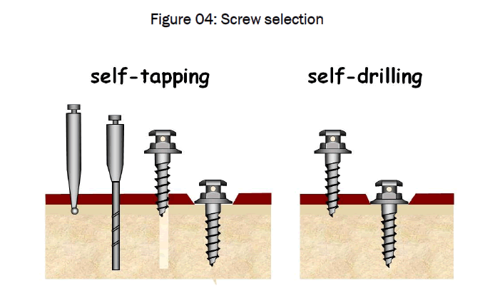 dental-sciences-Screw-selection