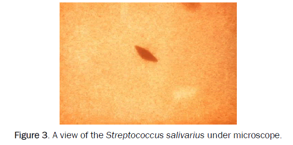 dental-sciences-Streptococcus-salivarius