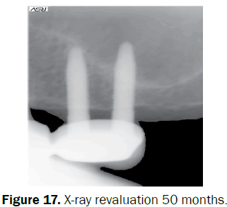 dental-sciences-X-ray