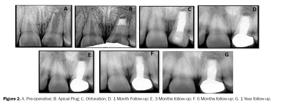 dental-sciences-Year-follow-up