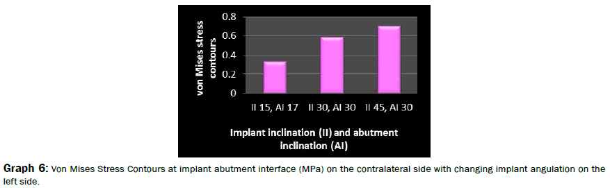 dental-sciences-abutment-interface-contralateral-implant