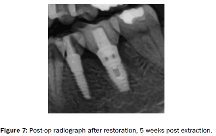 dental-sciences-after-restoration