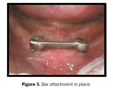 dental-sciences-attachment
