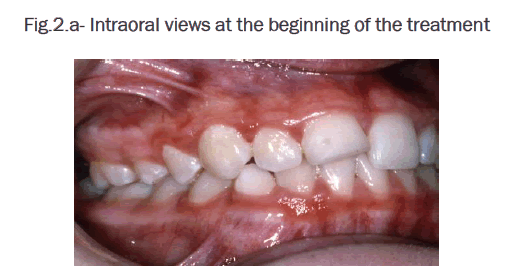 dental-sciences-beginning-treatment