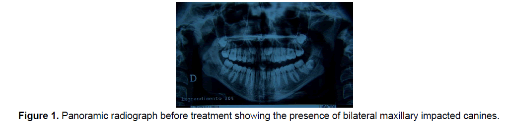 dental-sciences-bilateral-maxillary