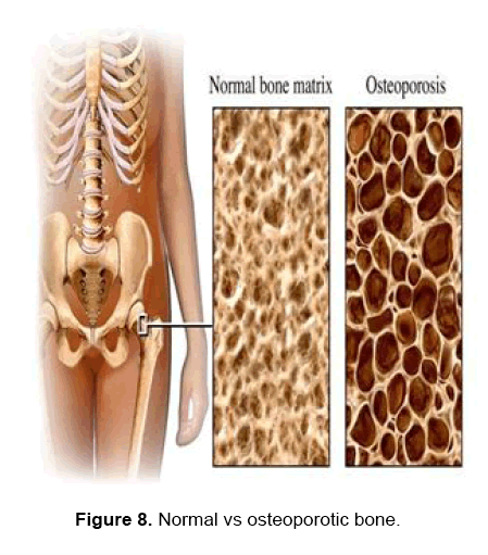 dental-sciences-bone