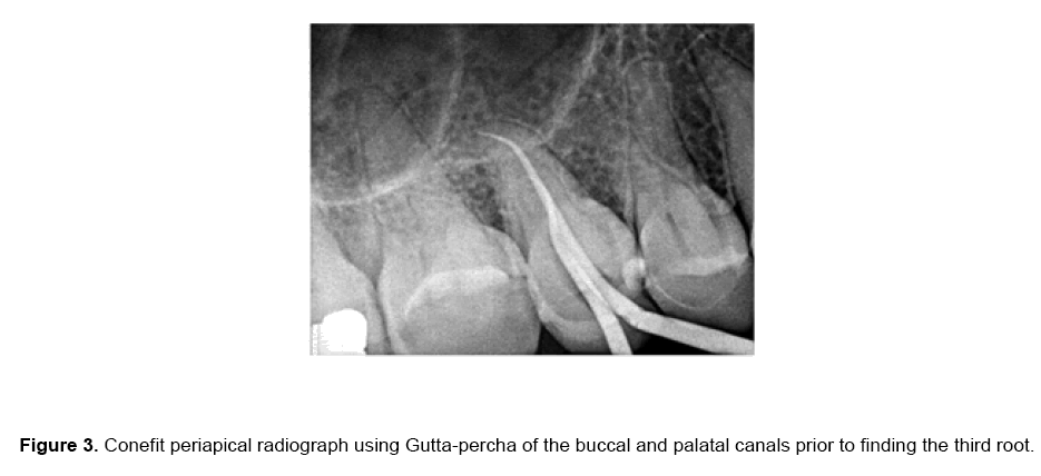 dental-sciences-canals