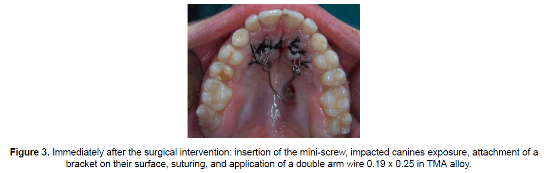 dental-sciences-canines-exposure