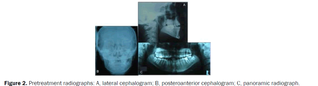 dental-sciences-cephalogram