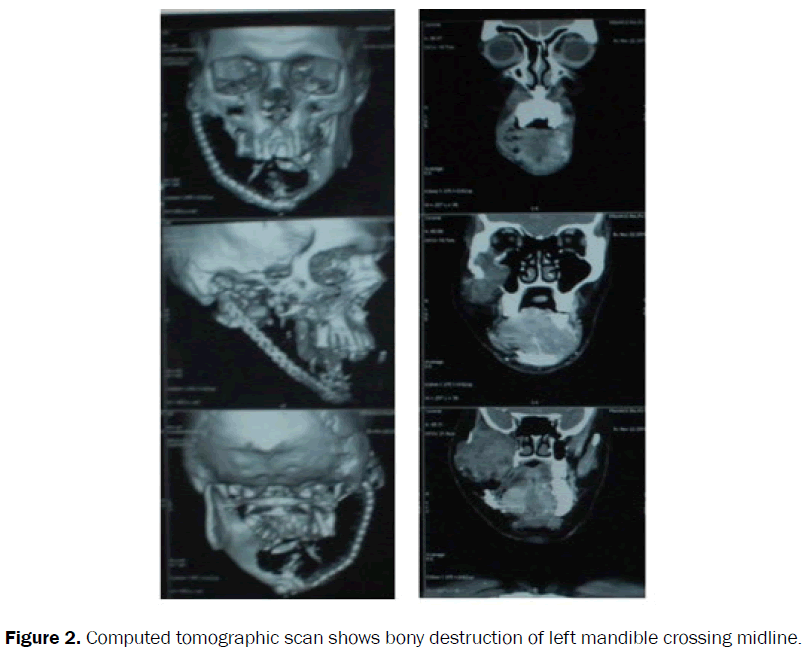 dental-sciences-computed-tomographic-scan