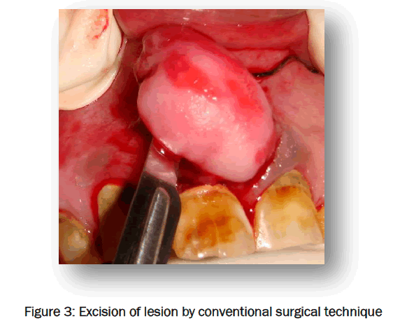 dental-sciences-conventional-surgical-technique