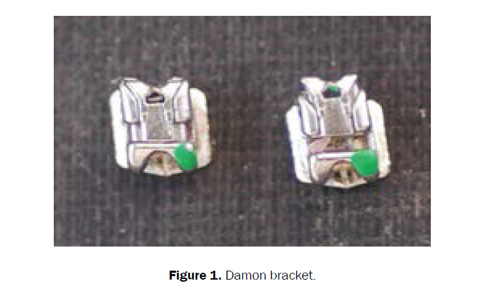 dental-sciences-damon-bracket