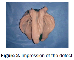 dental-sciences-defect