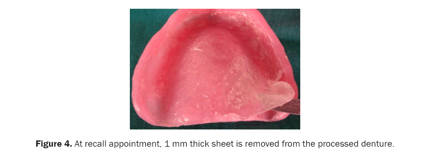 dental-sciences-denture