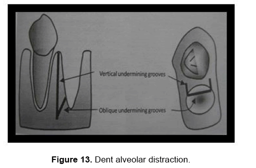 dental-sciences-distraction