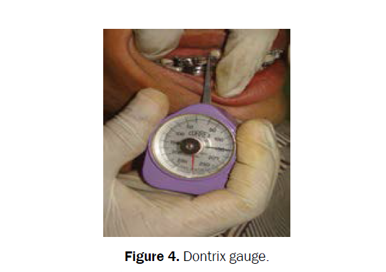 dental-sciences-dontrix-gauge