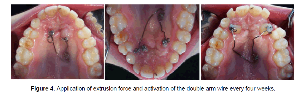 dental-sciences-double-arm