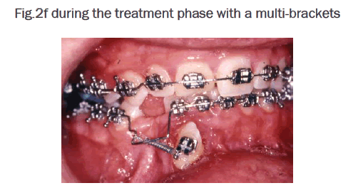 dental-sciences-during-treatment-phase