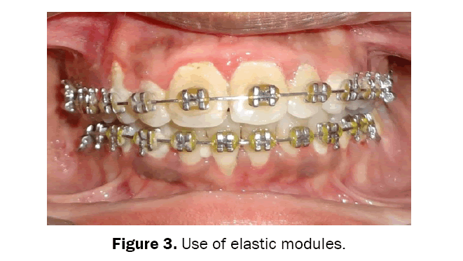 dental-sciences-elastic-modules