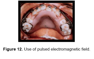 dental-sciences-electromagnetic