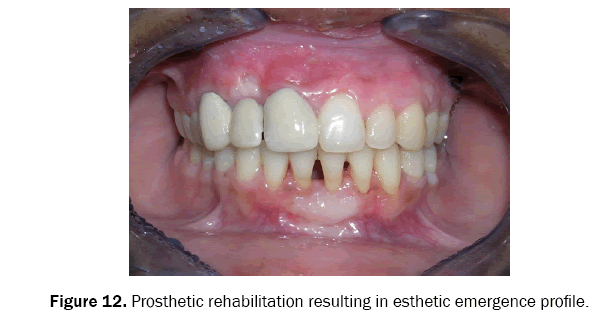 dental-sciences-esthetic