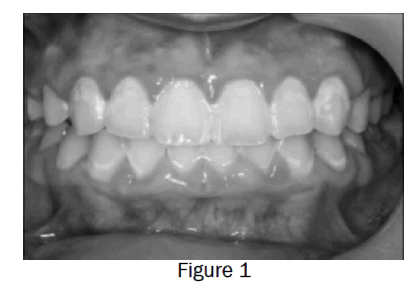 dental-sciences-figure1