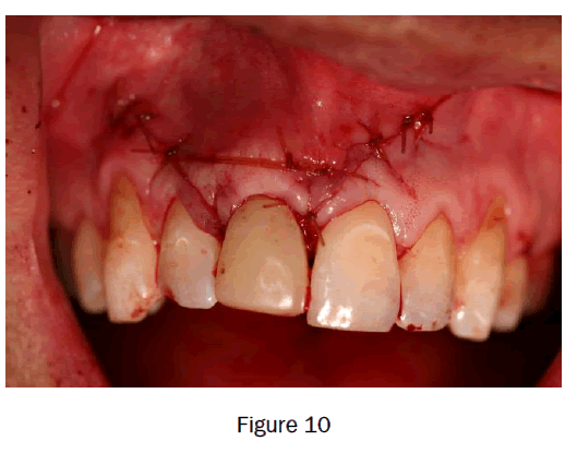 dental-sciences-figure10