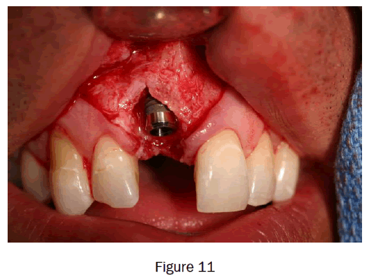 dental-sciences-figure11