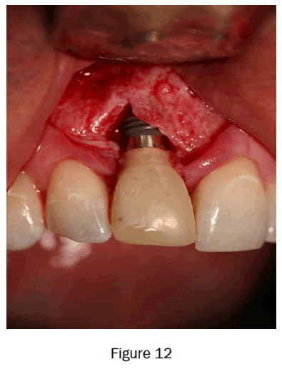 dental-sciences-figure12