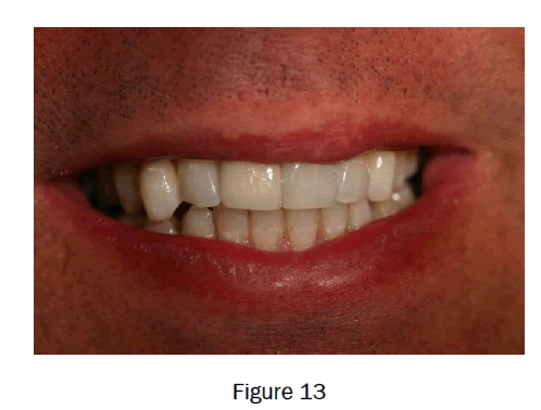 dental-sciences-figure13