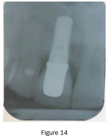 dental-sciences-figure14