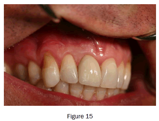 dental-sciences-figure15