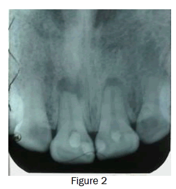 dental-sciences-figure2