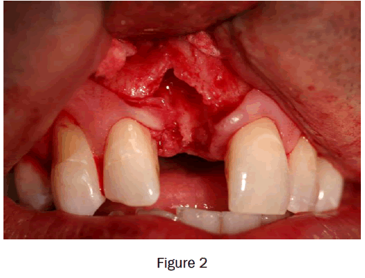 dental-sciences-figure2