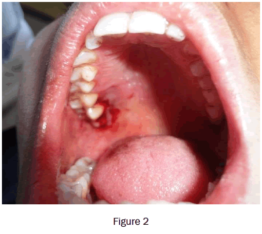 dental-sciences-figure2