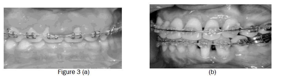 dental-sciences-figure3