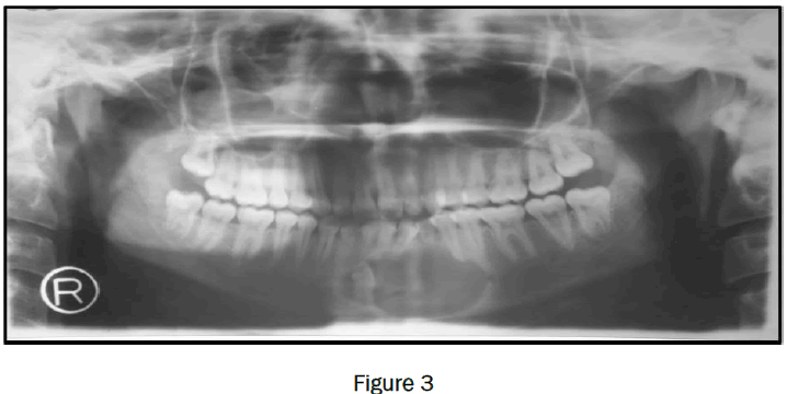 dental-sciences-figure3