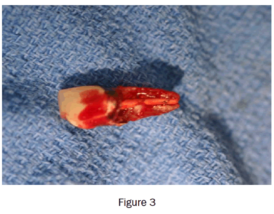 dental-sciences-figure3