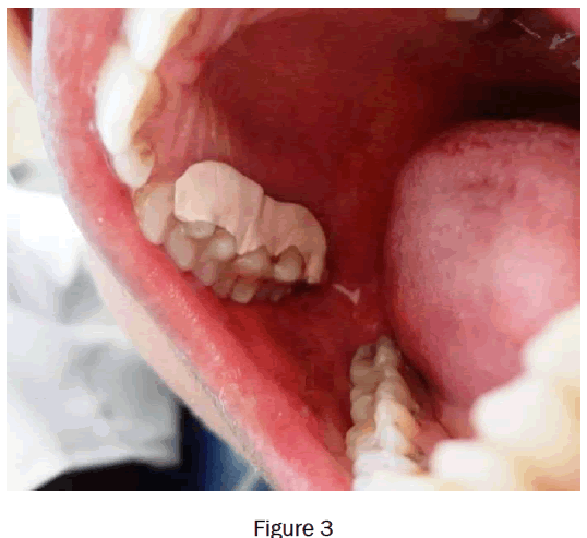 dental-sciences-figure3