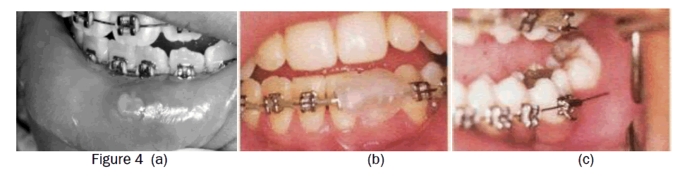 dental-sciences-figure4