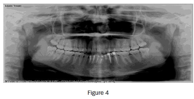 dental-sciences-figure4