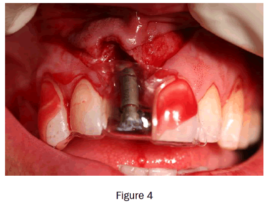 dental-sciences-figure4