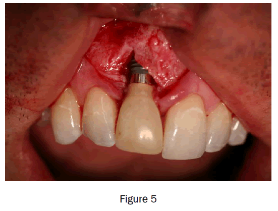 dental-sciences-figure5