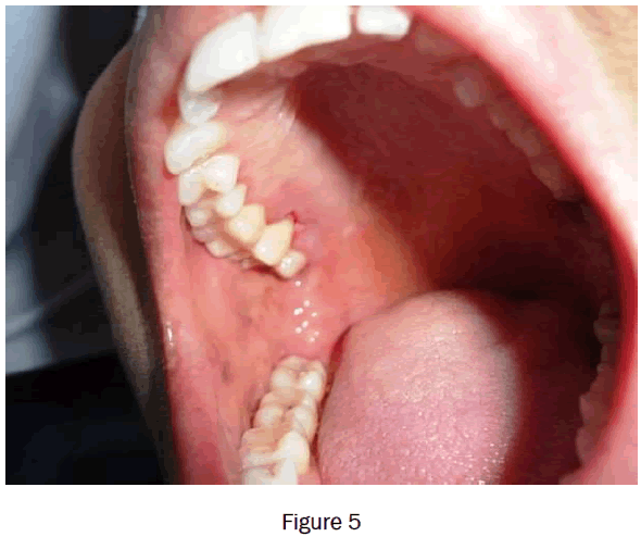 dental-sciences-figure5