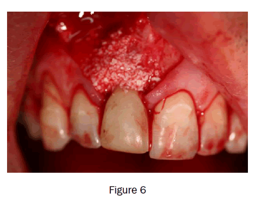 dental-sciences-figure6
