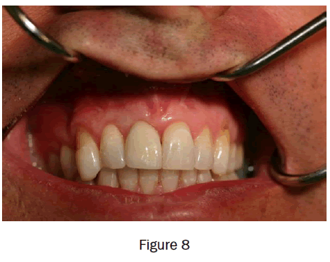 dental-sciences-figure8